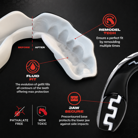 VENTO Boil & Bite Mouth Guard – Custom Fit Sports Mouthguard for Boxing, MMA, Muay Thai, Kickboxing, Rugby & Martial Arts